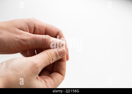 Gros plan des ongles fragiles sur la main de la femme. Arrière-plan blanc. Brocken et sécher les ongles. Avitaminose et déficits micro-éléments Banque D'Images