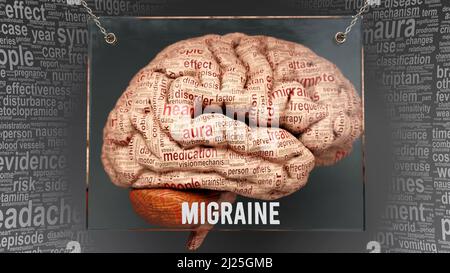 Anatomie de la migraine - ses causes et effets projetés sur un cerveau humain révélant la complexité et la relation de Migraine avec l'esprit humain. Concept art, 3D illustr Banque D'Images