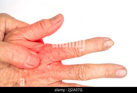 Aspect dorsal douloureux du vieil homme asiatique. Concept de tendonitis et de douleurs musculaires de main. Banque D'Images