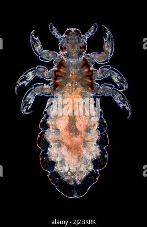 Souris à tête humaine, serre-tête (Pediculus humanus capitis), photomicrographe à fond noir Banque D'Images