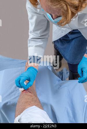 Infirmière soignante blessure fraîche sang sur l'os tibial de la jambe. Coller des points pour tenir la coupe. Banque D'Images