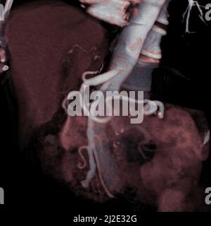 Abdomen, scan Banque D'Images