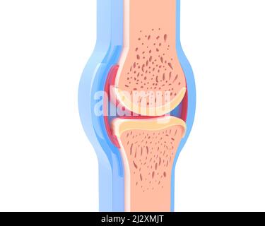 Ixometric 3D illustration d'une articulation synoviale humaine. Image anatomique transparente montrant l'intérieur en coupe. Sur fond blanc. Banque D'Images