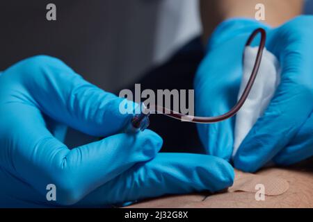 Le médecin recueille le sang dans une seringue, une infirmière prend le sang de les veines sur le bras Banque D'Images