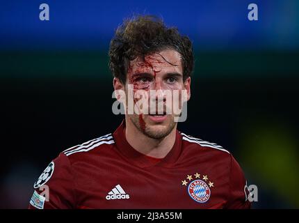 VILA-REAL, 7 avril 2022 (Xinhua) -- Leon Goretzka du Bayern Munich se blesse lors d'un match de la Ligue des champions de l'UEFA entre Villarreal CF d'Espagne et le Bayern Munich d'Allemagne au stade de la Ceramica à Vila-Real, Espagne, le 6 avril 2022. (str/Xinhua) Banque D'Images