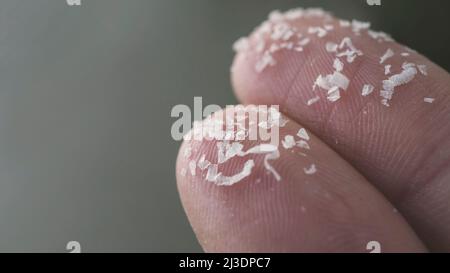 Gros plan de microplastiques sur les doigts humains. Concept de pollution de l'eau et de réchauffement de la planète. L'idée du changement climatique. Banque D'Images