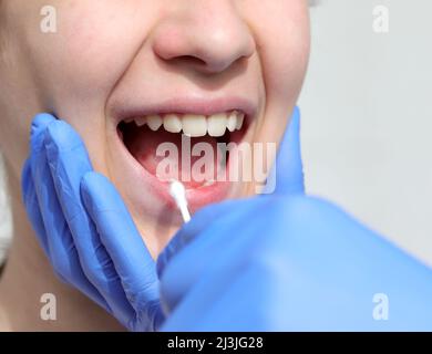 Gants en latex bleu du médecin qui effectue un test par écouvillonnage oral pour la détection du coronavirus chez la jeune fille Banque D'Images