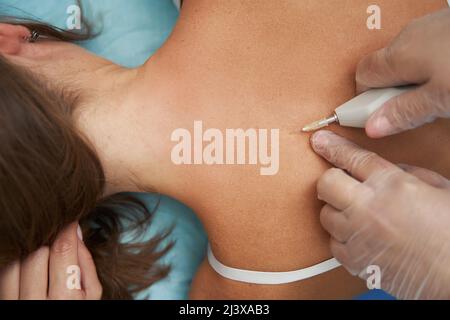 Médecin faisant l'injection de dioxyde de carbone dans le dos de la femme Banque D'Images