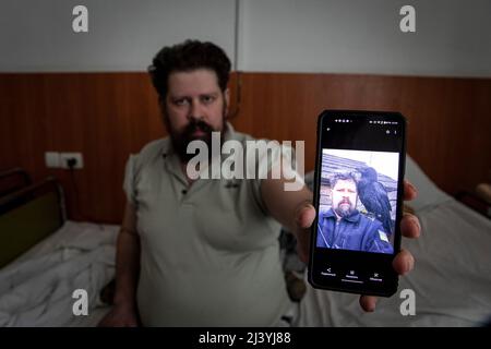 30 mars 2022, Kiev, Ukraine: Andrey Bychenko (32), de Gosteml, Kyiv Oblast, blessé par de multiples fractures osseuses et de graves pertes de sang causées par une mine terrestre russe le 25 février affiche un écran de smartphone avec une photo de son ami qui a été tué par les bombardements russes. Alors que la guerre continue de faire rage, de nombreux civils ukrainiens ont été blessés et tués sous les feux croisés et l'offensive russe, et les hôpitaux de Kiev sont maintenant remplis de survivants sous traitement médical. Selon les Nations Unies, jusqu'en mars 23, plus de 977 civils ont été tués et 1 594 blessés. (Image de crédit : © A Banque D'Images