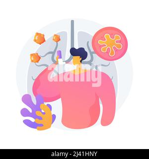 Illustration du vecteur de concept abstrait de l'anaphylaxie. Aide à la réaction allergique grave, traitement de choc anaphylactique, cas d'allergie d'urgence, hypersensibilité Illustration de Vecteur