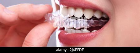 Close-up of a Woman's Hand Putting Alignement Transparent dans les dents Banque D'Images