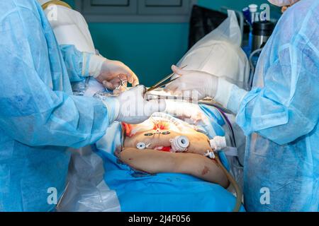 L'équipe médicale effectue une opération sur la cavité abdominale. Mise au point sélective. Groupe de chirurgiens au travail dans la salle d'opération. Instruments chirurgicaux entre les mains des médecins. Banque D'Images