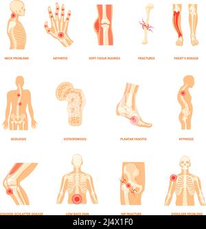 Problème orthopédique du corps. Lésion osseuse humaine, anatomie santé maladies arthrite plantaire fracture articulaire douleur au pied épaule genou arrière cheville sport blessures vecteur. Illustration de blessures dues à un problème humain Illustration de Vecteur