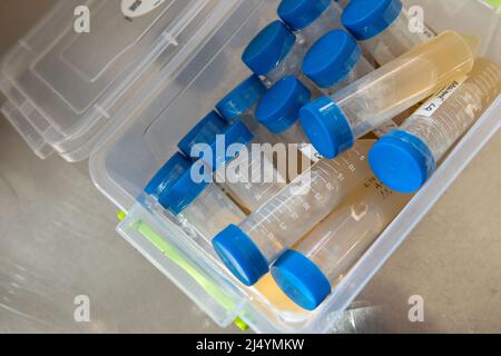 tube à centrifuger avec un milieu nutritif pour le développement du mycélium. Mycologie professionnelle, culture de champignons Banque D'Images