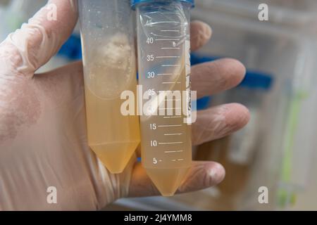 tube à centrifuger avec un milieu nutritif pour le développement du mycélium. Mycologie professionnelle, culture de champignons Banque D'Images