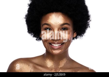 Portrait de la jeune et belle femme noire avec le trouble de peau de vitiligo Banque D'Images