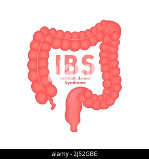 Signes du syndrome du côlon irritable. Messages de santé sur le diagnostic de l'IBS. Illustration du stock vectoriel. Illustration de Vecteur