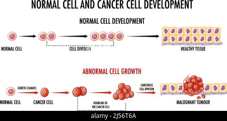 Schéma illustrant une cellule normale et une cellule cancéreuse Illustration de Vecteur