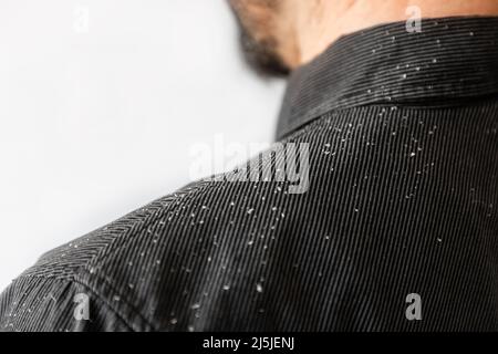 Un homme barbu dans une chemise noire, une vue rapprochée de l'épaule couverte de pellicules. Copier l'espace. Le concept du psoriasis et de la dermatite séborrhéique. Banque D'Images