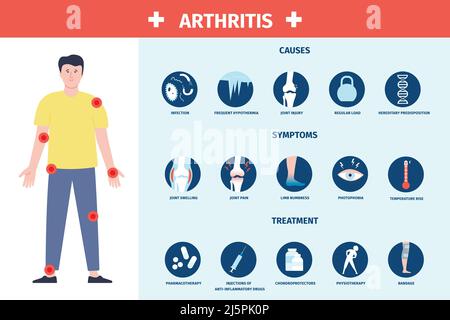 Infographie sur l'arthrite. Inflammation et soins, symptômes et traitement. Affiche de soins de santé avec des points humains et de douleur, bannière récente de l'hôpital vecteur Illustration de Vecteur