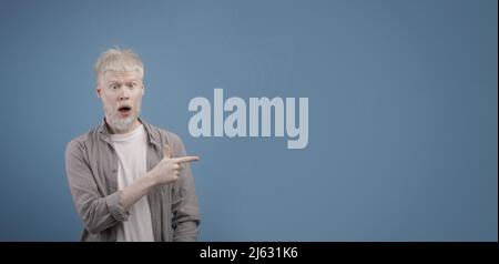 Concept de promotion. Jeune albino surpris gars pointant de côté à l'espace de copie et regardant la caméra avec la bouche ouverte Banque D'Images