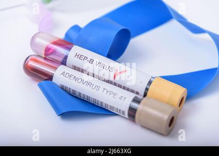 Suspicion d'adénovirus en tant que coupable de l'hépatite infantile d'origine inconnue. Hépatique, sras-cov2. Banque D'Images