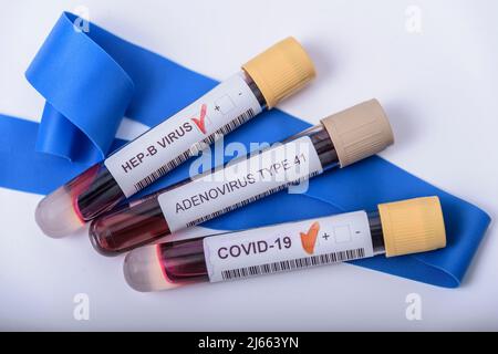 Suspicion d'adénovirus en tant que coupable de l'hépatite infantile d'origine inconnue. Hépatique, sras-cov2. Banque D'Images