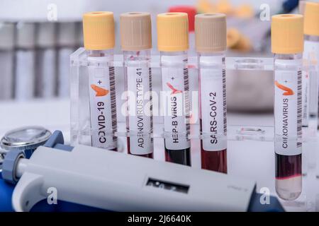 Suspicion d'adénovirus en tant que coupable de l'hépatite infantile d'origine inconnue. Hépatique, sras-cov2. Banque D'Images