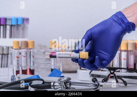 Suspicion d'adénovirus en tant que coupable de l'hépatite infantile d'origine inconnue. Hépatique, sras-cov2. Banque D'Images