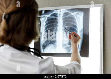 Thérapeute pulmonaire examinant une radiographie des poumons. Concept de soins de santé et d'assurance médicale Banque D'Images