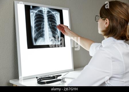 Thérapeute pulmonaire examinant une radiographie des poumons. Concept de soins de santé et d'assurance médicale Banque D'Images