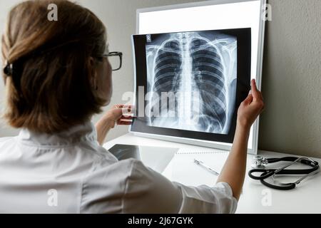 Thérapeute pulmonaire examinant une radiographie des poumons. Concept de soins de santé et d'assurance médicale Banque D'Images