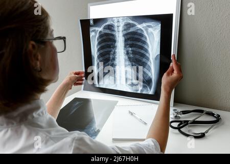 Thérapeute pulmonaire examinant une radiographie des poumons. Concept de soins de santé et d'assurance médicale Banque D'Images