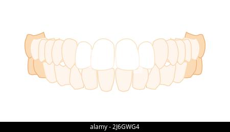 Dents rangée prothèse gros plan vue ventrale antérieure avant humaine. Modèle à mâchoires avec dents. Ensemble de bosse réaliste plat naturel couleur concept illustration vectorielle de l'anatomie isolée sur fond blanc Illustration de Vecteur