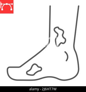 Icône de la ligne du pied diabétique, ulcère et maladie, icône du vecteur du pied diabétique, graphiques vectoriels, signe de contour modifiable de l'AVC, eps 10. Illustration de Vecteur