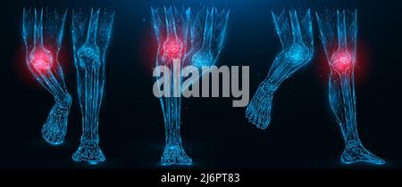 Illustration vectorielle polygonale des jambes humaines, maladie inflammatoire du concept de l'articulation du genou. Membres inférieurs en poly-art sur fond bleu foncé. Illustration de Vecteur