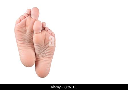 Semelles de pieds sèches et fissurées sur fond blanc. Peau rugueuse sur pieds femelles isolées sur fond blanc. Gros plan des fissures sur les talons avec mauvaise peau c Banque D'Images