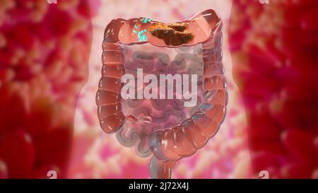 3d illustration de l'anatomie du système digestif humain, concept de l'intestin, laxatif, traitement de la constipation, 3d rendu Banque D'Images