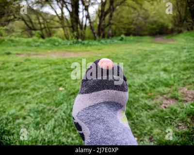 Gros trou dans une chaussette Banque D'Images