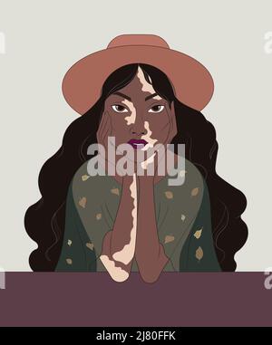 Magnifique visage de mode féminin avec Vitiligo Illustration de Vecteur