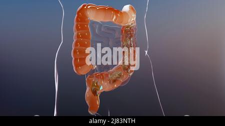 3d illustration de l'anatomie du système digestif humain, concept de l'intestin, laxatif, traitement de la constipation, 3d rendu Banque D'Images