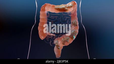 3d illustration de l'anatomie du système digestif humain, concept de l'intestin, laxatif, traitement de la constipation, 3d rendu Banque D'Images