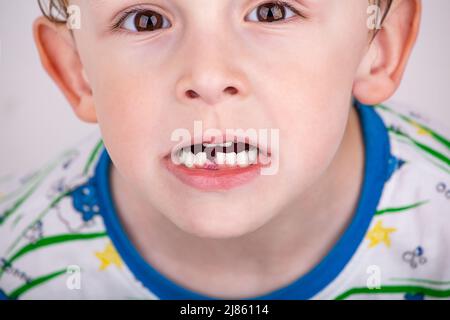 Perte de la première dent de bébé chez un enfant Banque D'Images