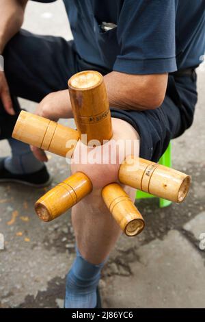 L'utilisation de la thérapie de trempage ( aspiration par le vide traitement à basse pression ) pour soulager les symptômes des problèmes articulaires de genou et la douleur pratiquée dans la rue à Xian / Xi'an, Chine. PRC. (125) Banque D'Images