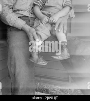 Tulare County. Dans le camp de l'Administration de la sécurité agricole (FSA) pour les travailleurs migrants. Bébé avec pieds de club portant des attelles faites maison à l'intérieur des chaussures. Banque D'Images