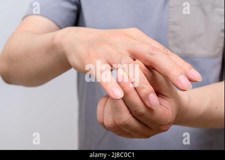 Mains d'hommes souffrant de douleurs articulaires des doigts. Causes de la polyarthrite rhumatoïde, goutte. Concept de soins de santé et de médecine. Banque D'Images