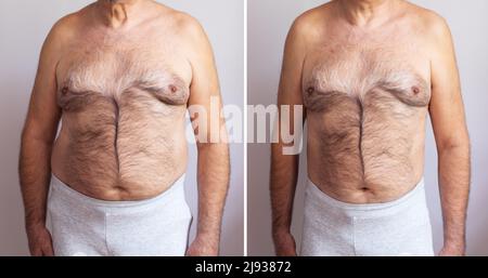 Portrait d'un homme mûr avant et après la perte de poids, sur fond blanc. La forme du corps a été modifié au cours de la retouche Banque D'Images