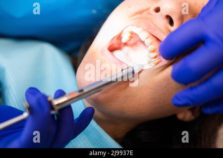 Mains du dentiste donnant l'anesthésie dentaire avec une seringue à sa patiente. Mise au point sélective. Banque D'Images