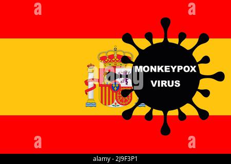 VIRUS DE LA VARIOLE DU SINGE. Drapeau de l'Espagne. Mpox. Clade 1b. La variole du singe. Vésicules de la variole du singe sur le bras. Virus, épidémie, maladie. Clade 2. Banque D'Images