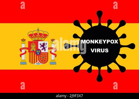 VIRUS DE LA VARIOLE DU SINGE. Drapeau de l'Espagne. Mpox. Clade 1b. La variole du singe. Vésicules de la variole du singe sur le bras. Virus, épidémie, maladie. Clade 2. Banque D'Images